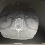 spinal cross section